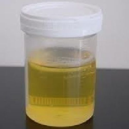 desi-cow-urine-1522240426-3753313